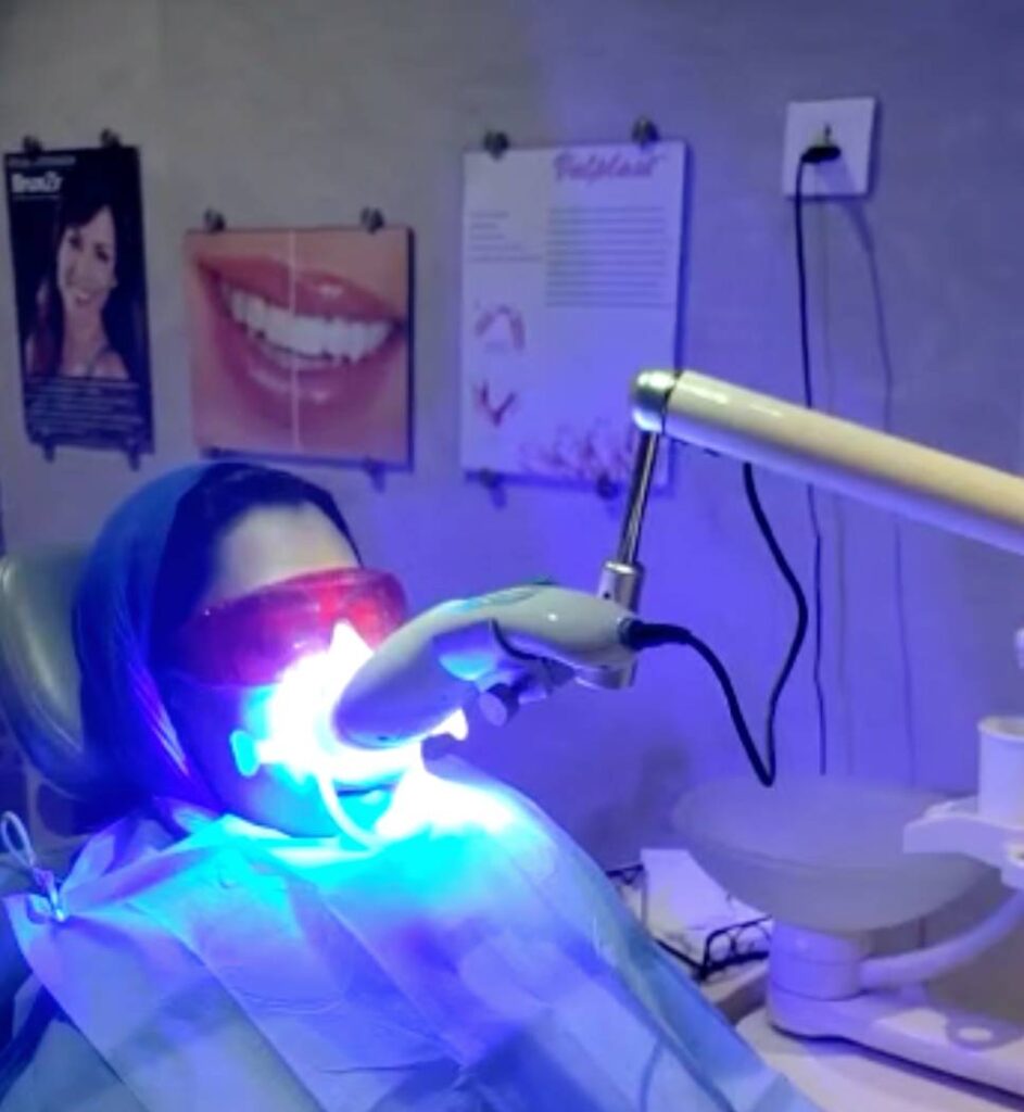 Teeth Whitening, Teeth Whitening Treatment,