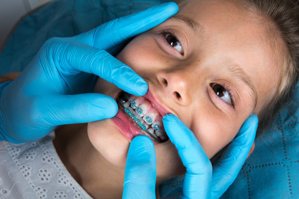 Child Dentistry, Child Dentistry Specialists, Pediatric Dentist, Pediatric Dentistry