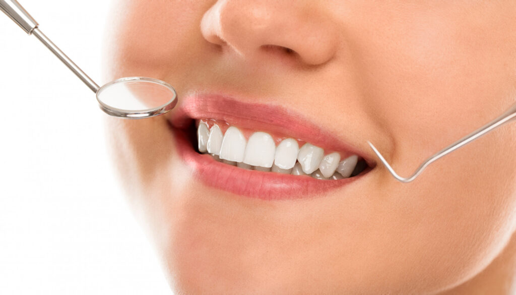 How to Rebuild Your Smile with Dental Veneers