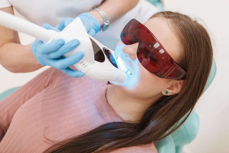Teeth Whitening Benefits
