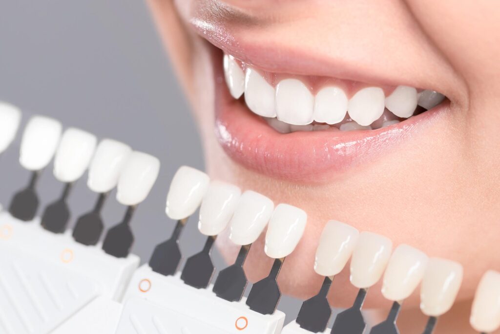 Cosmetic Dentistry in Mumbai