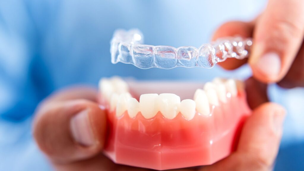 Clear Aligner Treatment Process