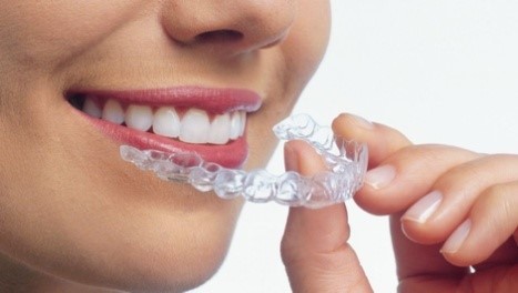 Orthodontic Treatment